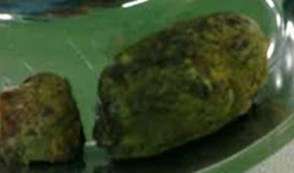 Miğdesinden Taş Çıktı